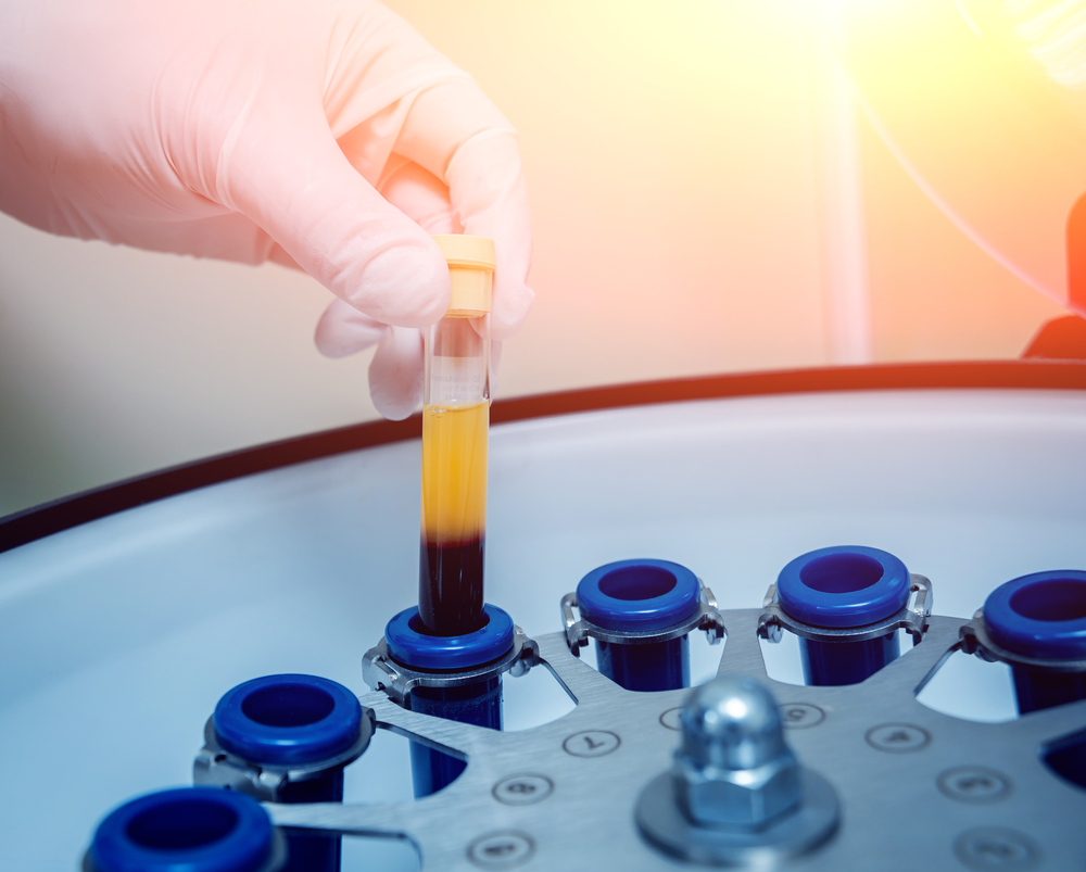 La France face à un défi crucial : la collecte de plasma